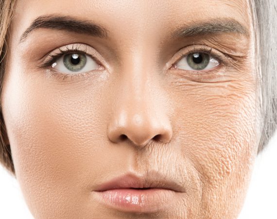 Rimpels en anti-aging